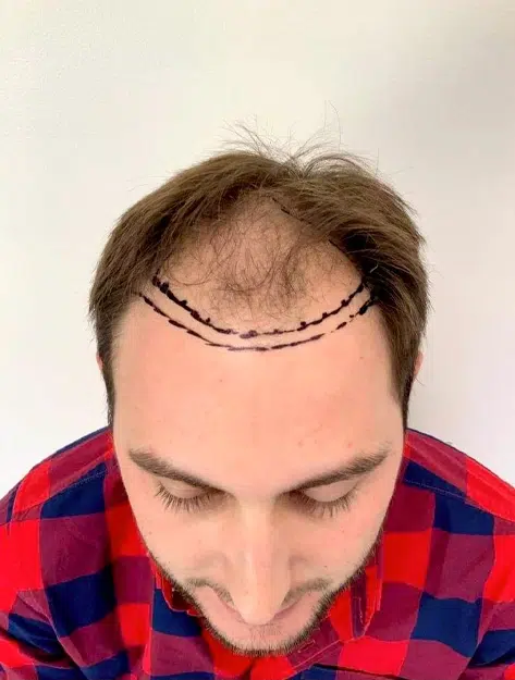 HAIR SPECIALIST